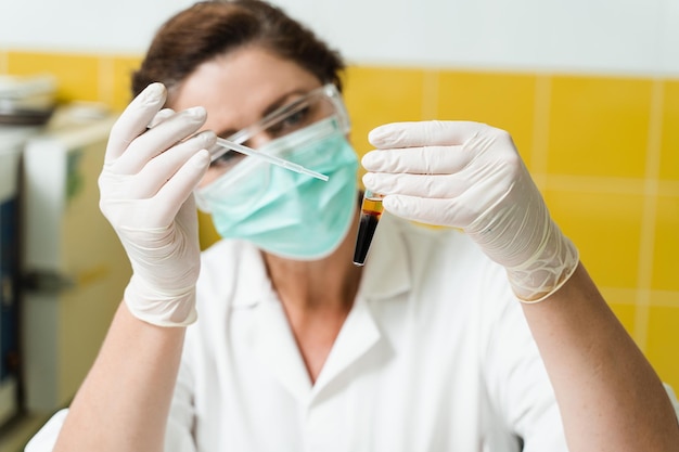 Osocze bogatopłytkowe co to jest i kiedy warto o nim pomyśleć?