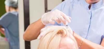 Czy mezoterapia włosów jest skuteczna?