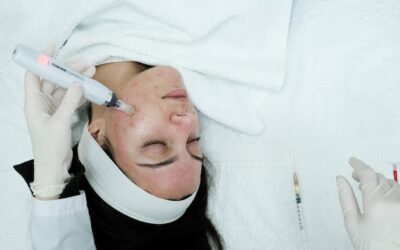 Dermapen kiedy widać efekty po zabiegu?