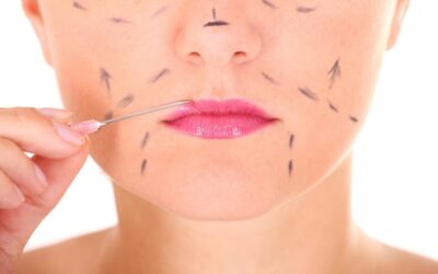 Ile goją się usta po modelowaniu?