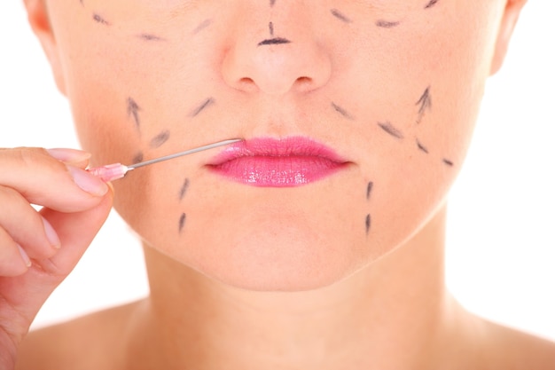 Ile goją się usta po modelowaniu?