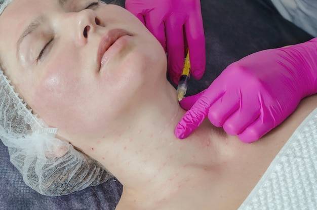 Jak długo grudki po mezoterapii mogą się utrzymywać?