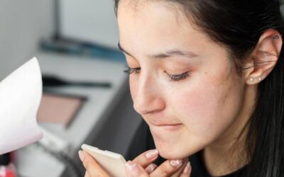 Jak pozbyć się blizny po trądziku domowymi sposobami?