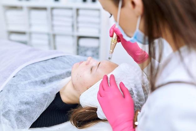 Jaki kwas hialuronowy do mezoterapii mikroigłowej sprawdzi się w domowej pielęgnacji?