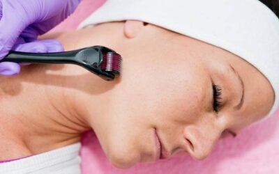 Dermaroller czy dermapen co lepiej sprawdzi się w domowej pielęgnacji?