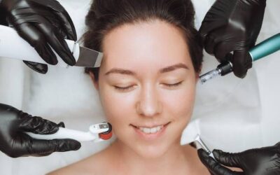 Ile trwa mezoterapia mikroigłowa i czego się spodziewać podczas zabiegu?