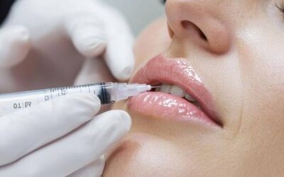 Czy powiększanie ust trzeba powtarzać?