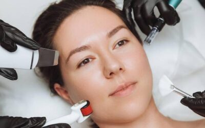 Dermapen co po zabiegu warto wiedzieć?