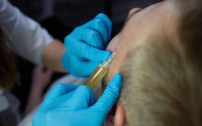 Ile kosztuje mezoterapia skóry głowy i co wpływa na cenę?