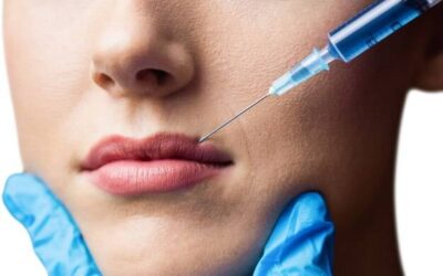 Ile kwasu hialuronowego potrzeba do powiększenia ust?