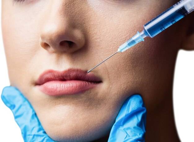 Ile kwasu hialuronowego potrzeba do powiększenia ust?