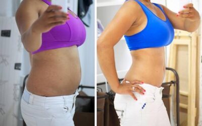 Jakie zabiegi na odchudzanie warto rozważyć?