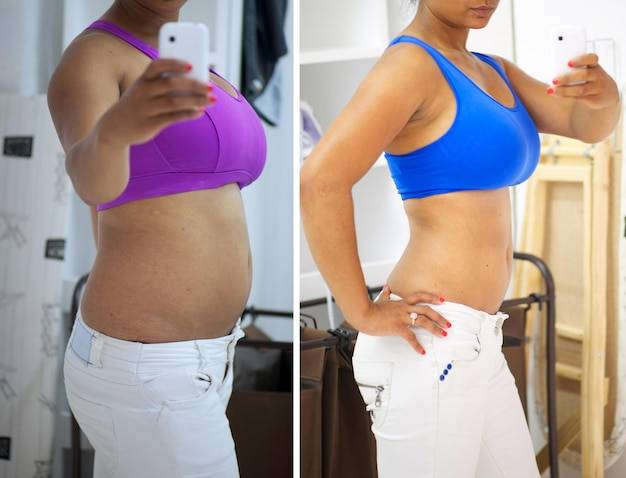 Jakie zabiegi na odchudzanie warto rozważyć?