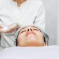 Peeling chemiczny co to jest i kiedy warto go rozważyć?