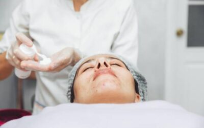 Peeling chemiczny co to jest i kiedy warto go rozważyć?