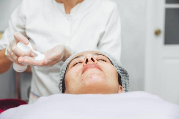 Peeling chemiczny co to jest i kiedy warto go rozważyć?