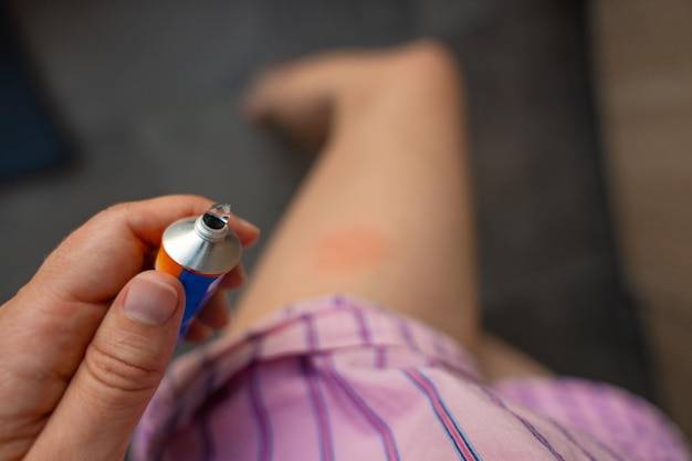 Siniak jak zlikwidować domowymi sposobami?