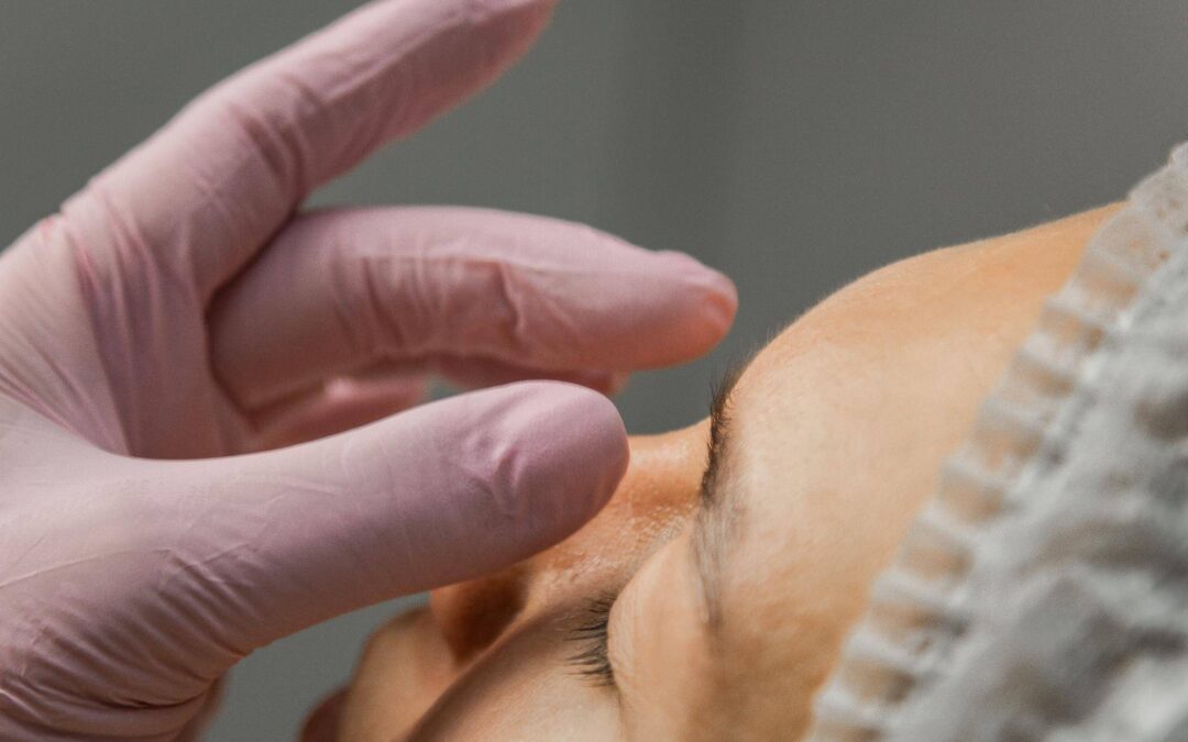 Jak usunąć bruzdy nosowo wargowe i odzyskać młodszy wygląd?