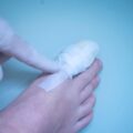 Buty po operacji na haluksa – jak nie zaszkodzić procesowi gojenia?