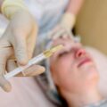 Kwas hialuronowy gdzie wstrzykiwać aby uzyskać naturalny efekt?