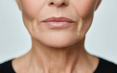 Czym wypełnić bruzdy nosowo wargowe aby uzyskać naturalny efekt?