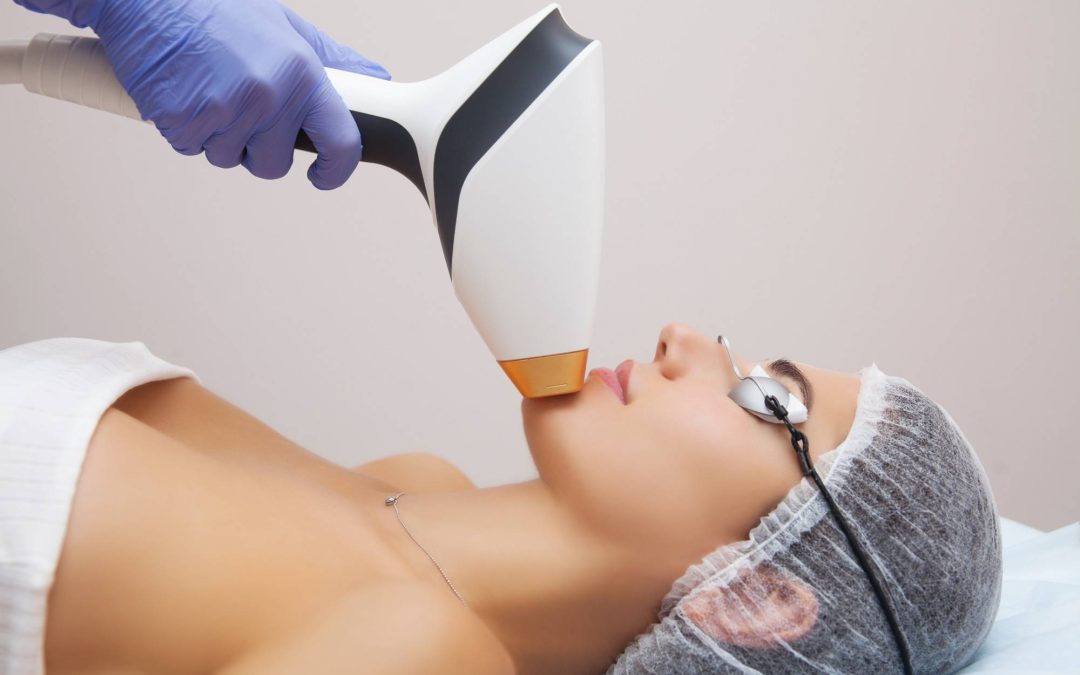 Jak wygląda twarz po laserze frakcyjnym i czego można się spodziewać?