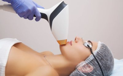 Jak wygląda twarz po laserze frakcyjnym i czego można się spodziewać?
